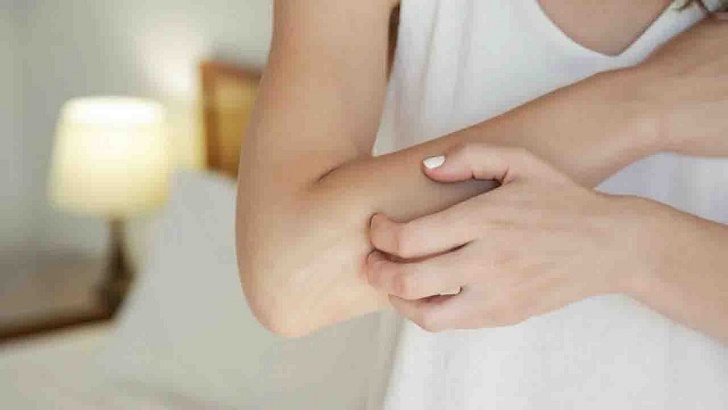 dry-skin